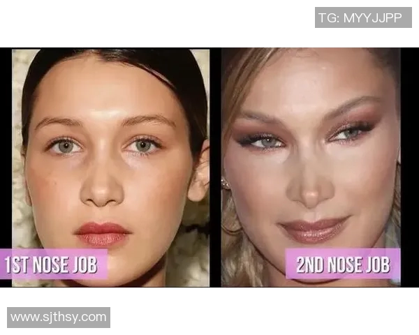 足球明星整容风波揭秘：颜值背后是否隐藏着不为人知的秘密